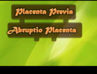 مشيمة بريفيا